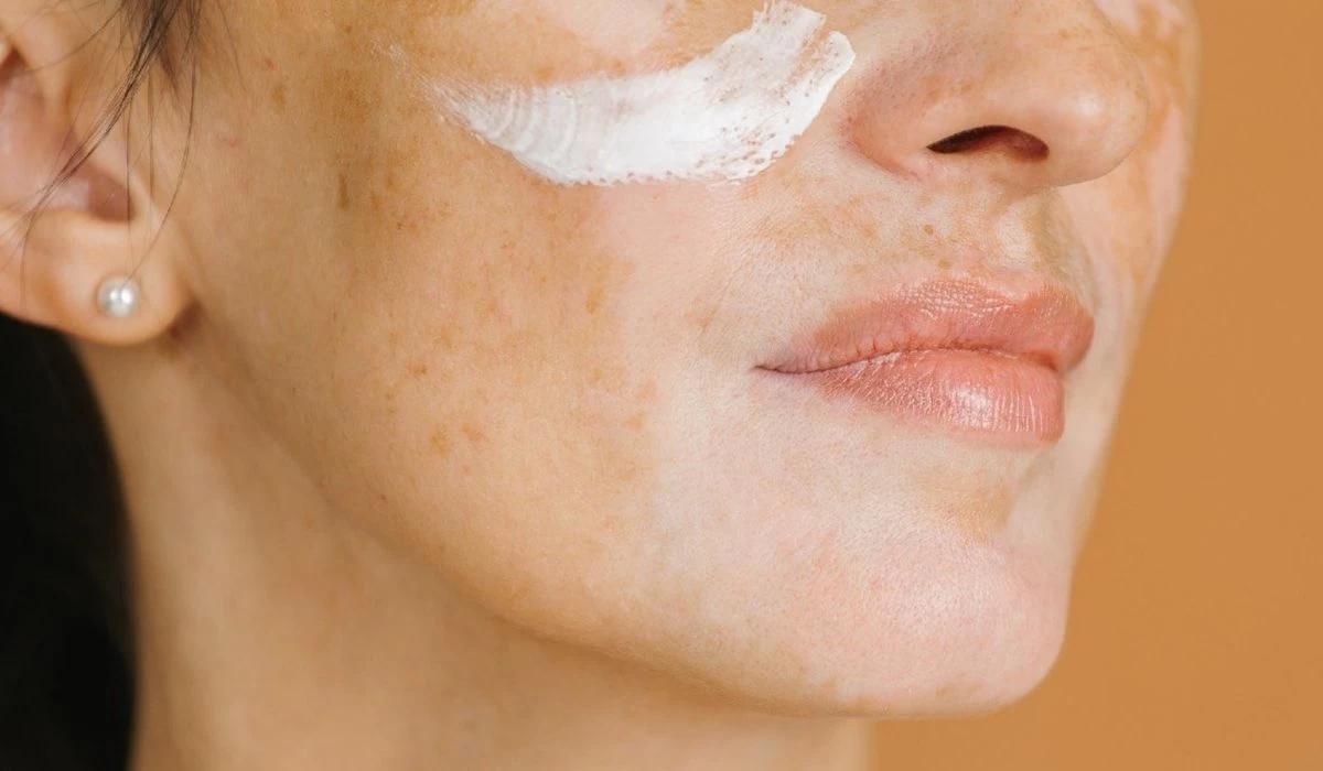 How to Repair a Damaged Skin Barrier